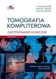 Tomografia komputerowa. Zastosowanie kliniczne