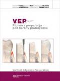 Vep pionowa preparacja pod korony protetyczne