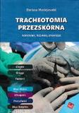 Tracheotomia przezskórna Podstawy techniki strategie