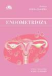 Endometrioza