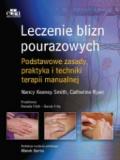 Leczenie blizn pourazowych. Podstawowe zasady, praktyka i techniki terapii manualnej