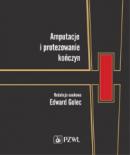 Amputacje i protezowanie kończyn