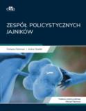 Zespół policystycznych jajników