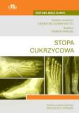 Stopa cukrzycowa