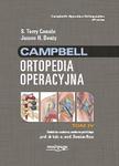Campbell Ortopedia Operacyjna Tom 4