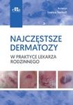 Najczęstsze dermatozy w praktyce lekarza rodzinnego