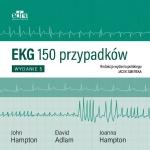 EKG 150 przypadków