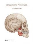 Okluzja w praktyce