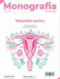 Monografia Mięśniaki macicy
