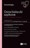 Ostre białaczki szpikowe Diagnozowane i leczenie W gabinecie lekarza specjalisty Hematologia
