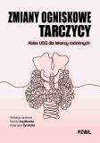 Zmiany ogniskowe tarczycy Atlas USG dla lekarzy rodzinnych