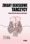 Zmiany ogniskowe tarczycy Atlas USG dla lekarzy rodzinnych