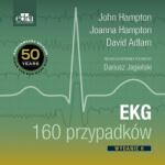 EKG 160 przypadków