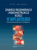 Zabiegi regeneracji i rekonstrukcji kości w implantologii