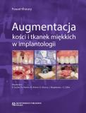 Augmentacja kości i tkanek miękkich w implantologii