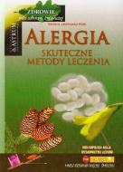 G-alergia-skuteczne-metody-leczenia-b-iext33791945_29094_150x190