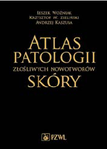 Atlas patologii złośliwych nowotworów skóry