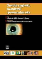 G-choroby-rogowki-twardowki-i-powierzchni-oka_6035_150x190