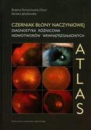 G-czerniak-blony-naczyniowej-diagnostyka-roznicowa-nowotworow-wewnatrzgalkowych_12717_150x190