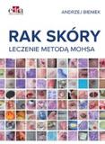 Rak skóry Leczenie metodą Mohsa