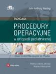 Procedury operacyjne w ortopedii pediatrycznej Tachdjian