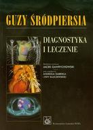G-guzy-srodpiersia-diagnostyka-i-leczenie_9056_150x190