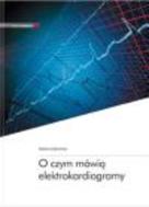 G-o-czym-mowia-elektrokardiogramy_10058_150x190