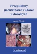 G-przepukliny-pachwinowe-i-udowe-u-doroslych_8140_150x190