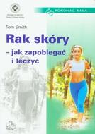 G-rak-skory-jak-zapobiegac-i-leczyc_6640_150x190