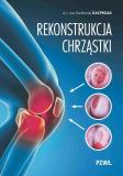 Rekonstrukcja chrząstki