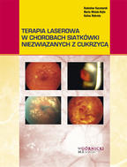 G-terapia-laserowa-w-chorobach-siatkowki-niezwiazanych-z-cukrzyca_5928_150x190