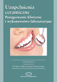 Uzupełnienia ceramiczne Postępowanie kliniczne i wykonawstwo laboratoryjne
