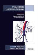G-zylna-choroba-zakrzepowo-zatorowa_11432_150x190